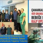 Çanakkale’de 458 Gramlk Prametüre Bebeğe Mucize Kalp Operasyonu